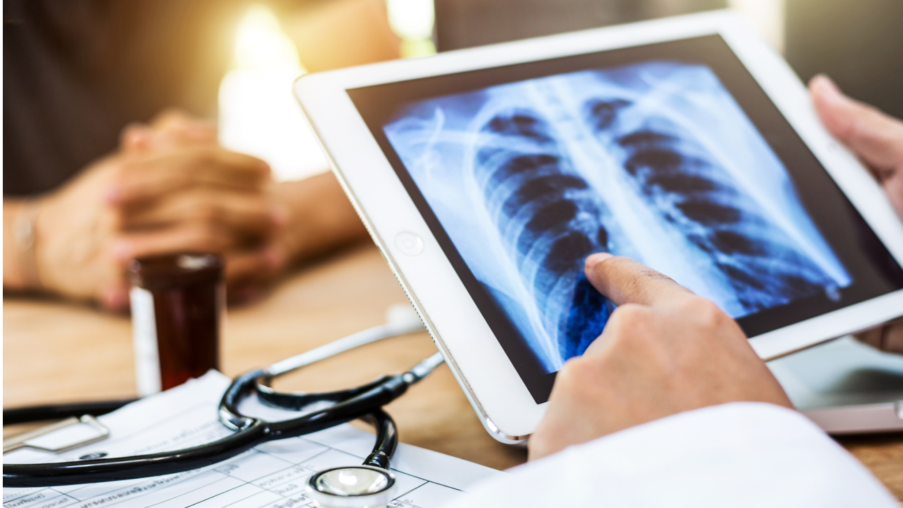 A doctor examines at a digital copy of a chest x-ray.